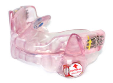 The SomnoDent with Compliance Recorder device is shown how it would fit orally in a patient’s mouth.